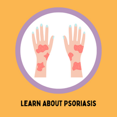 Learn About Psoriasis | ImmunaRelief Resource Center