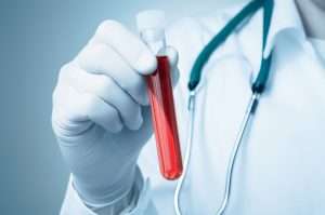 Person in labcoat holding a tube of red liquid