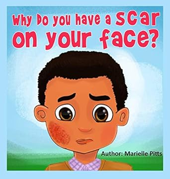 Why do you have a scar on your face?