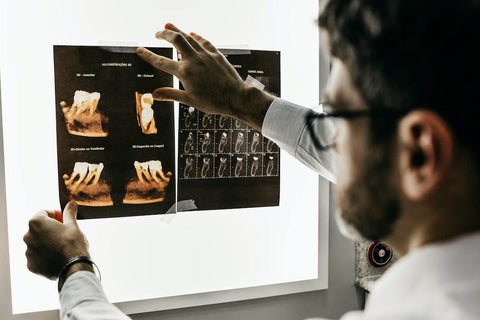 dentist looking at x-ray of teeth