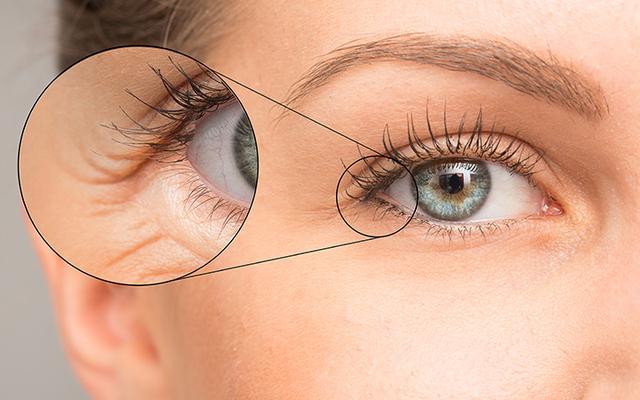 Уред за премахване на бръчките по очите в домашни условия