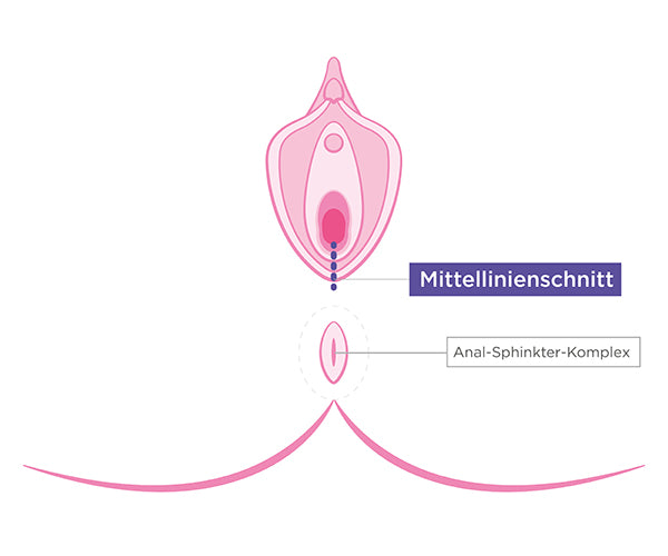 Mittellinienschnitt