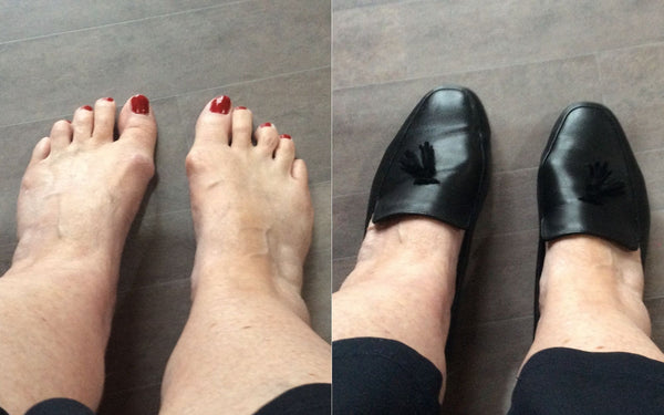 Calla shoes review | Carole loves her Calla shoes