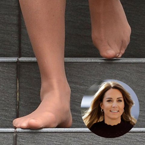 celebrities with bunions kate middleton feet