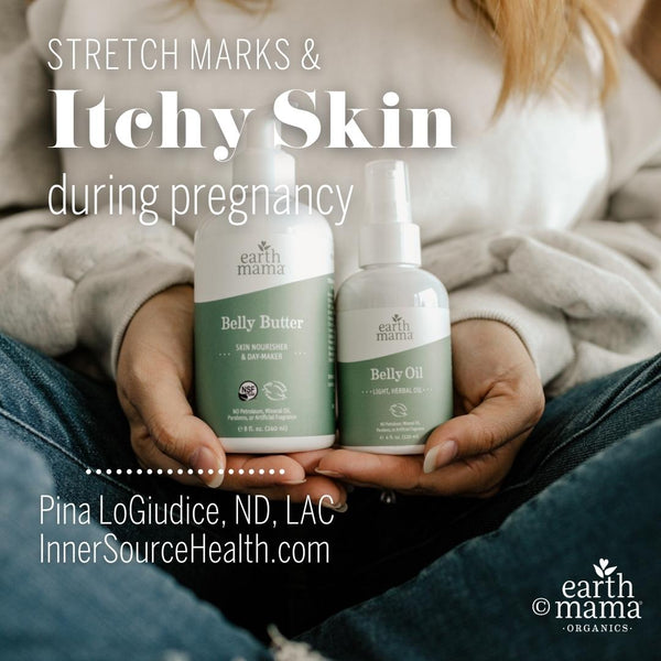 Stretch Marks & Itchy Skin During Pregnancy