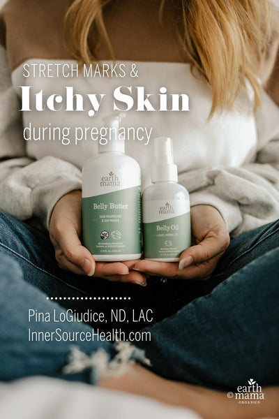 Stretch Marks & Itchy Skin During Pregnancy