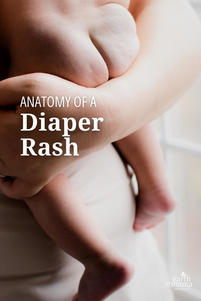 Anatomy of a Diaper Rash: Try this handy checklist and diaper cream recommendation