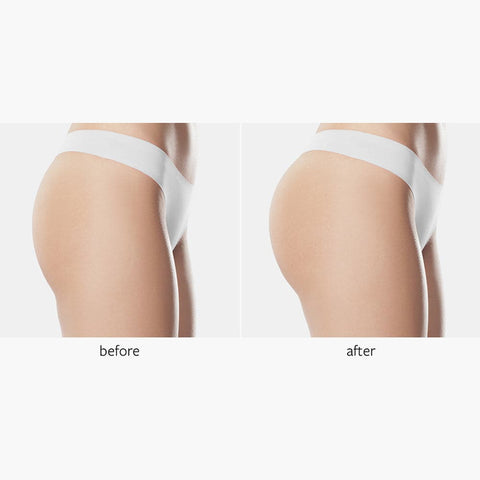 Buy ZITIQUE Strong tummy tuck, seamless tummy tuck, butt lift