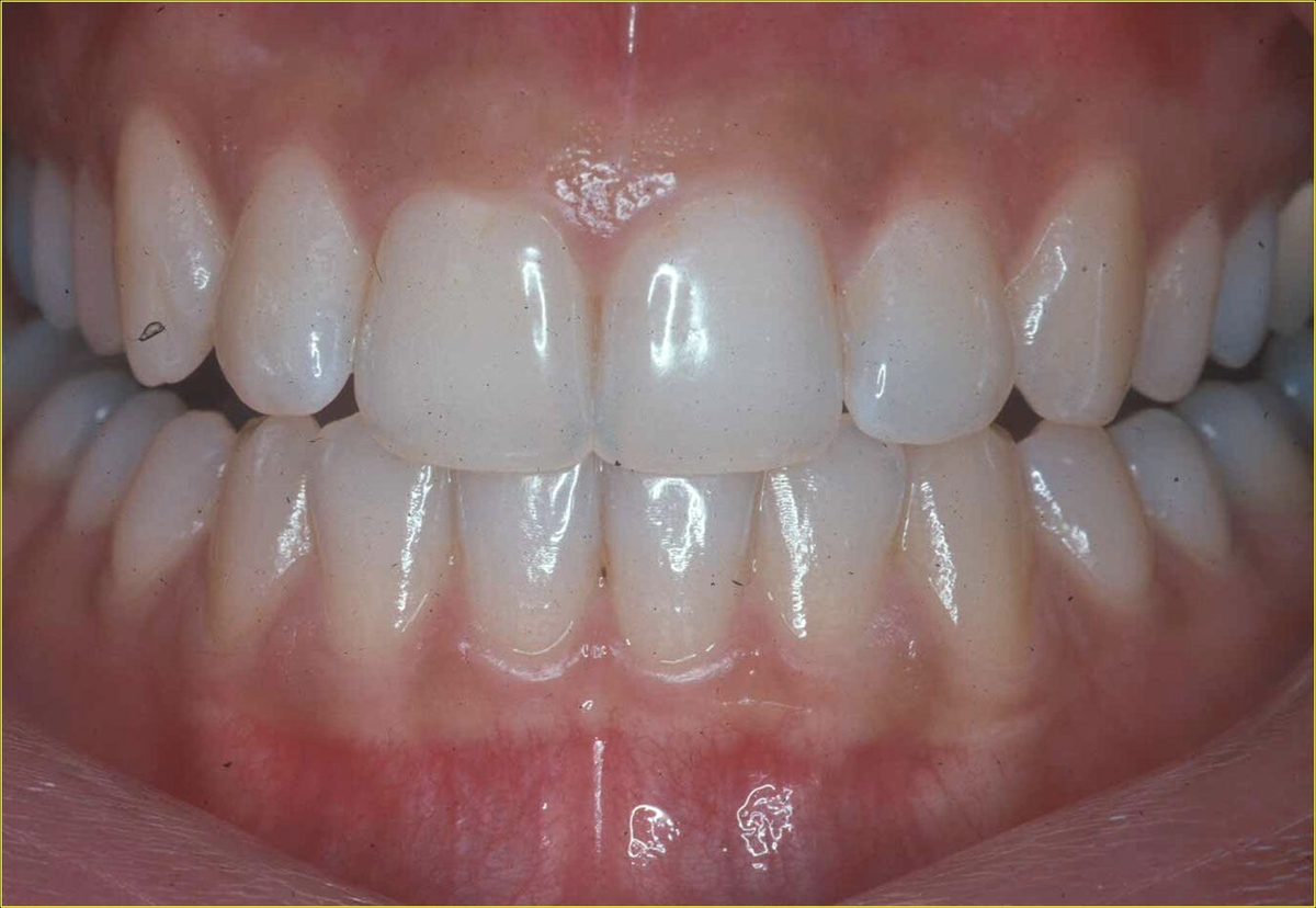 pictures of unhealthy gums        <h3 class=