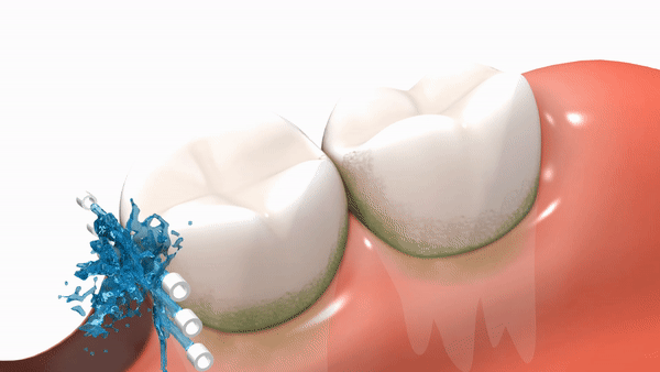 Instafloss Cleaning the Teeth and Gumline