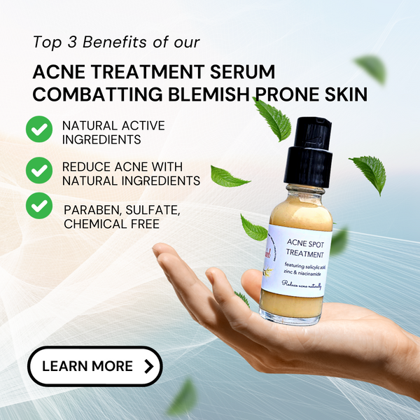 blemish prone skin