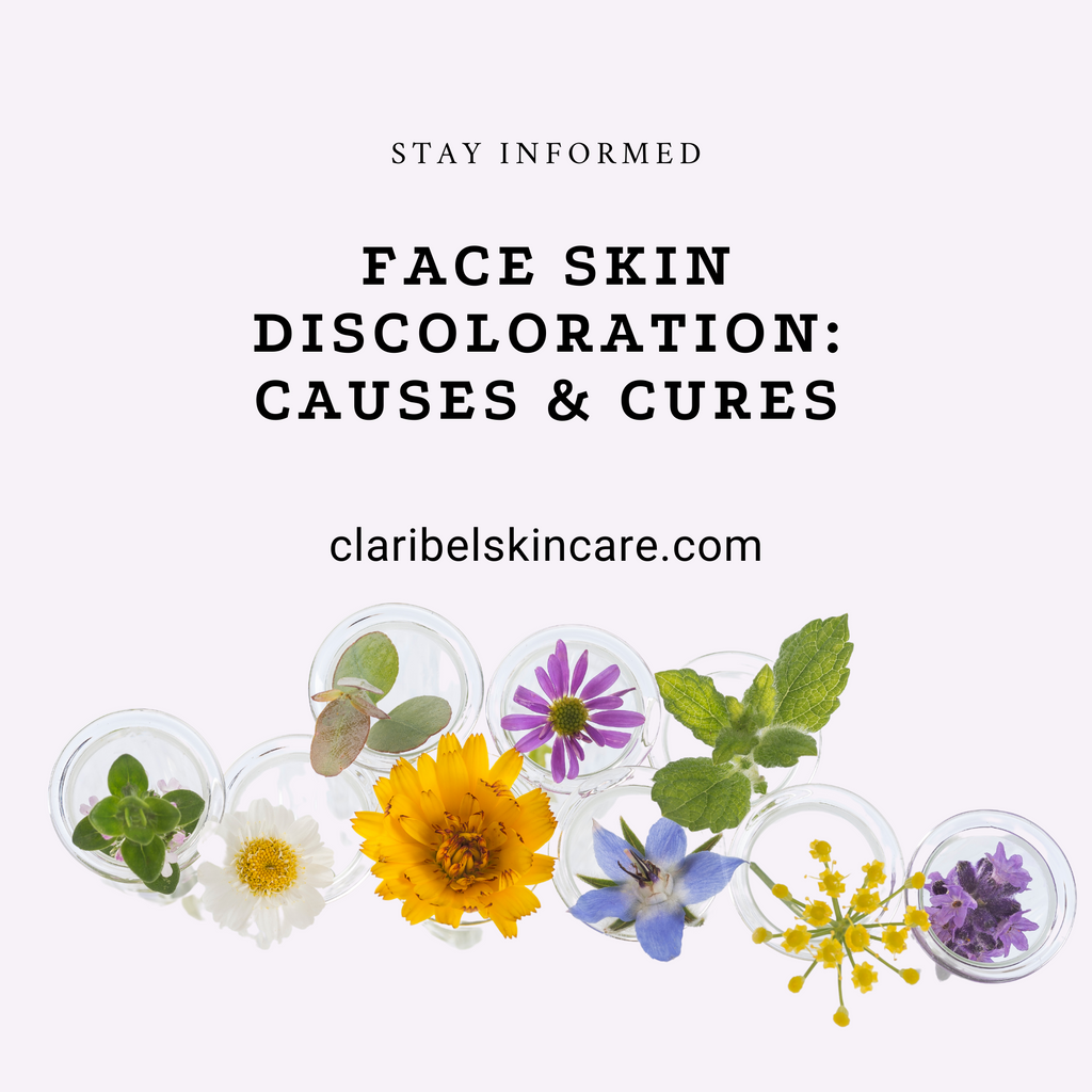 face skin discoloration