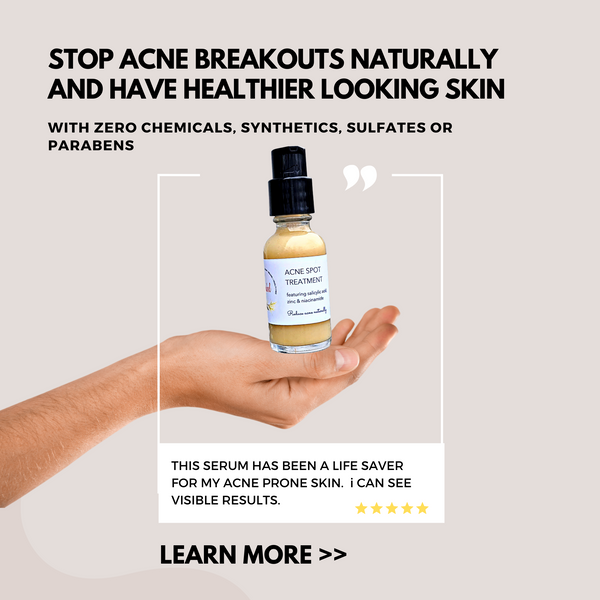 how to stop an acne breakout