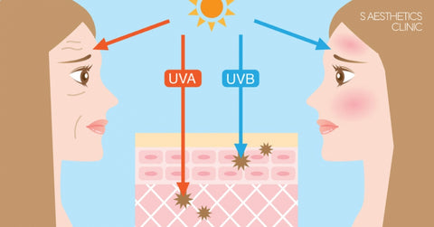 UV radiation types and how it damages human skin layers.