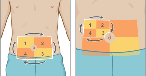 Rotation des injections d'insuline