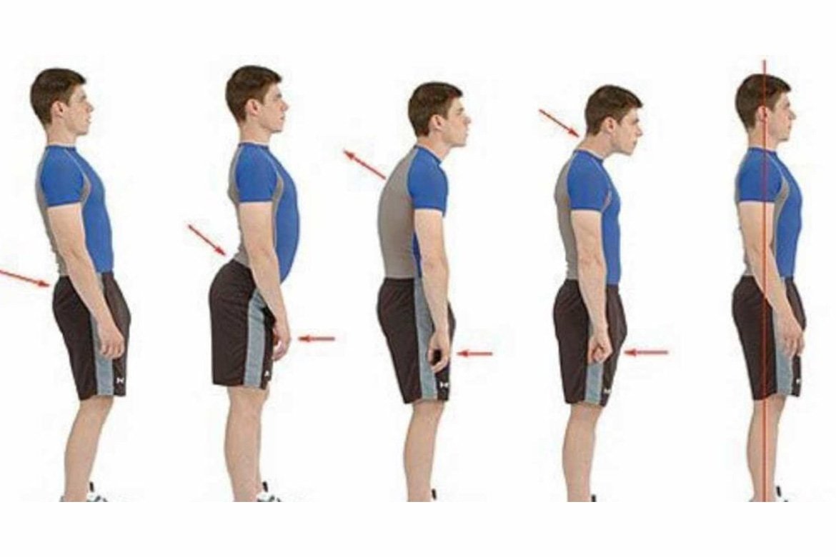 Guide to Back Posture Management 2021 - Strack Smart Posture Device ...