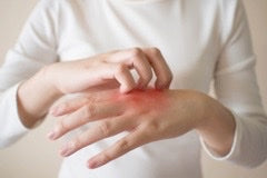 Allergien bei Friseuren treten vor allem an den Händen auf, ausgelöst durch Inhaltsstoffe in Produkten