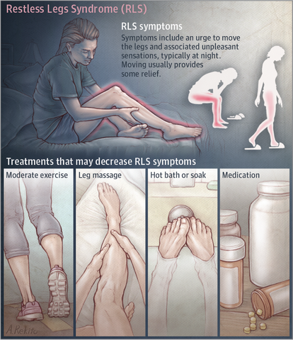 restless leg syndrome