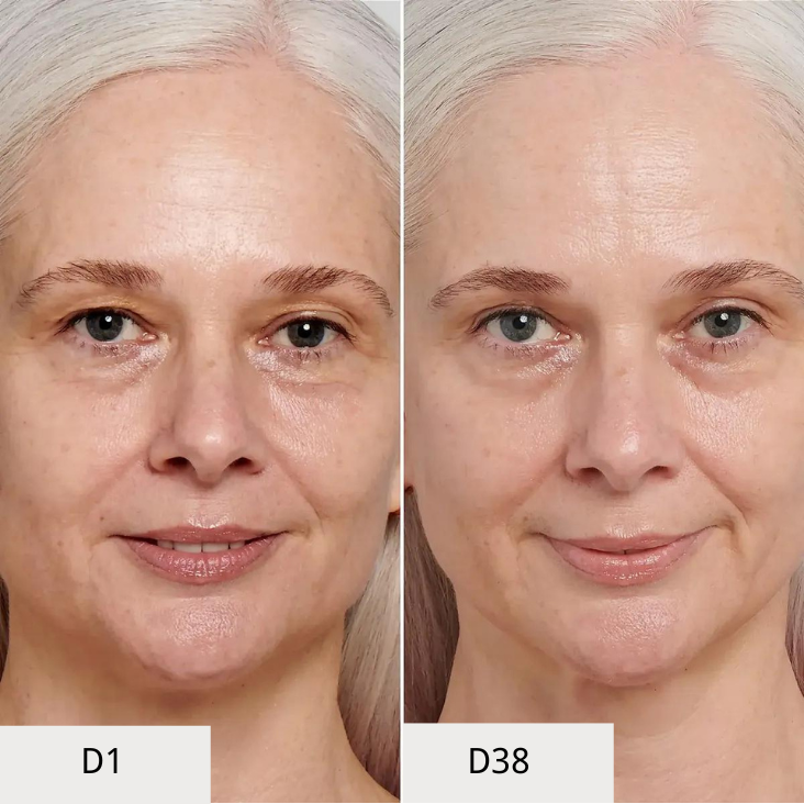 Bruadar Before and After anti-aging