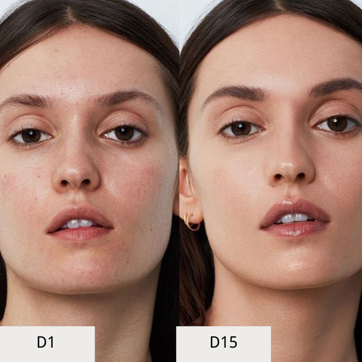 BRUADAR_SKINCARE_RESULTS