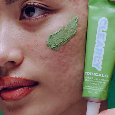 Non-comedogenic skincare product Topicals Clearly calming mask applied to cheek of person with acne-prone skin.