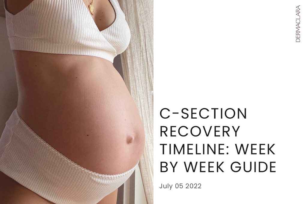 MY REAL POSTPARTUM BODY  CSection Recovery, Perks of Small Boobs