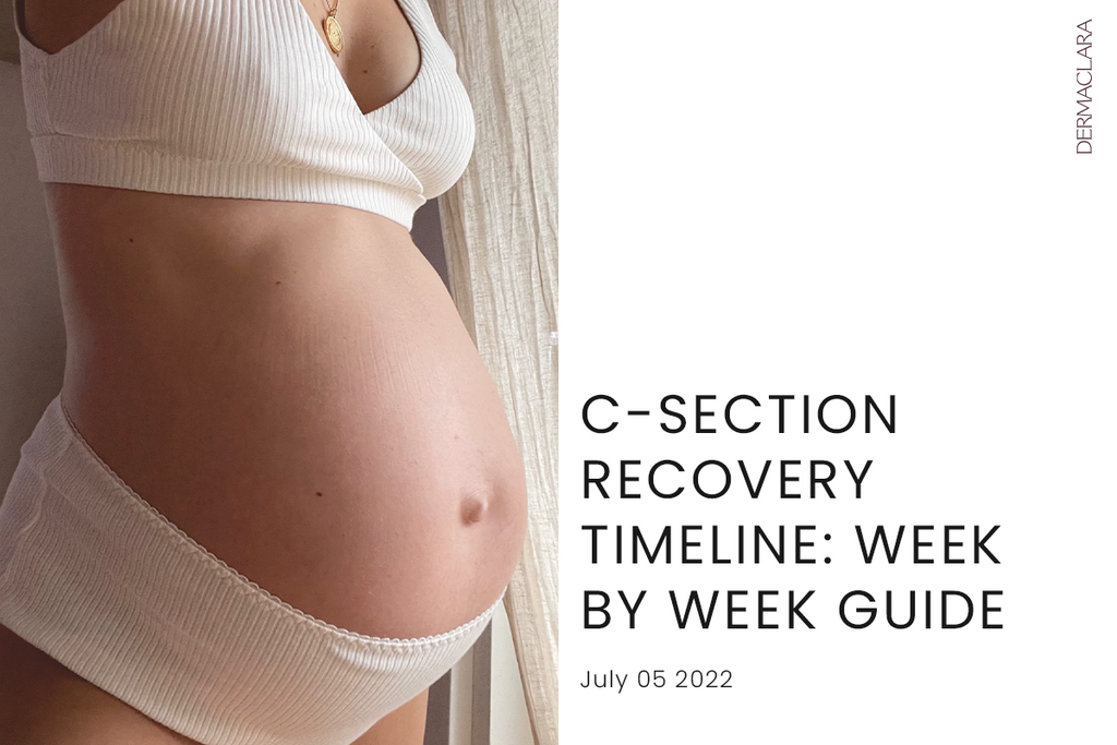 C-Section Recovery Timeline: Week By Week Guide