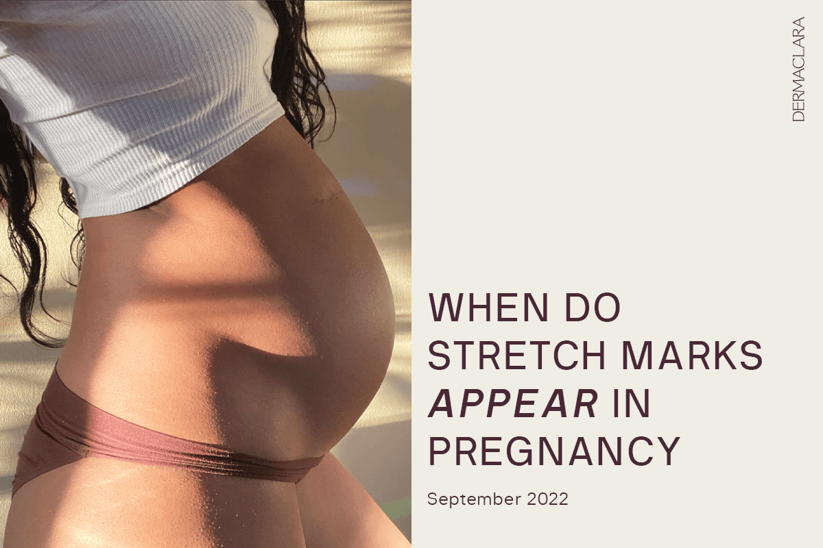 When Do Stretch Marks Appear In Pregnancy? | Dermaclara
