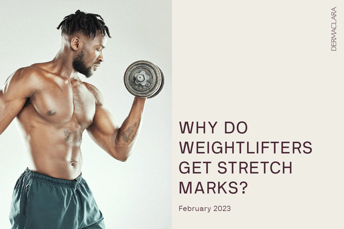 Why do weightlifters get stretch marks?