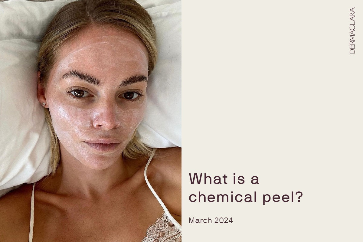 chemical peel near me