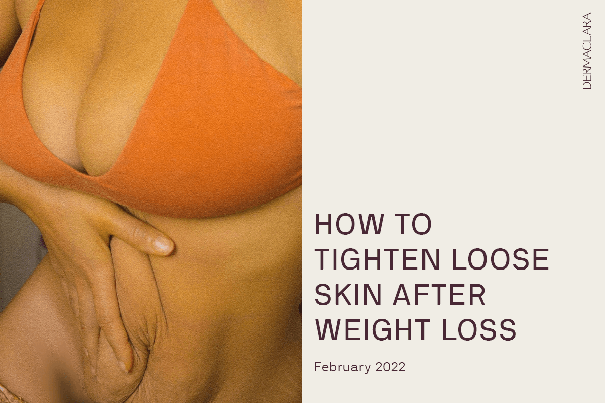 How To Tighten Loose/Sagging Skin After Bariatric Surgery?