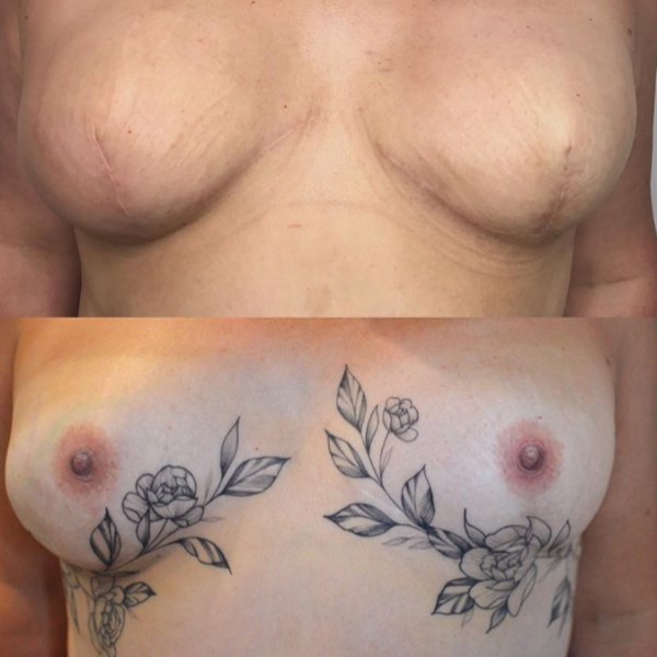 Areola Tattooing Gallery Image 12