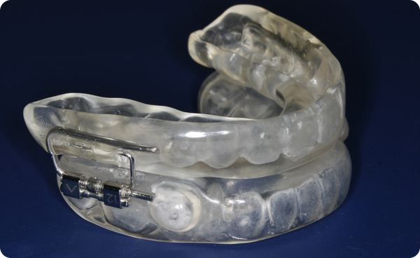 Sleep Apnea dental oral appliance non-invasive therapy