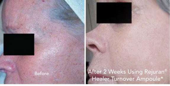 Before and After of Skin After Using Anti-Aging Serum