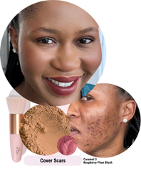natural mineral coverage for acne scars and marks