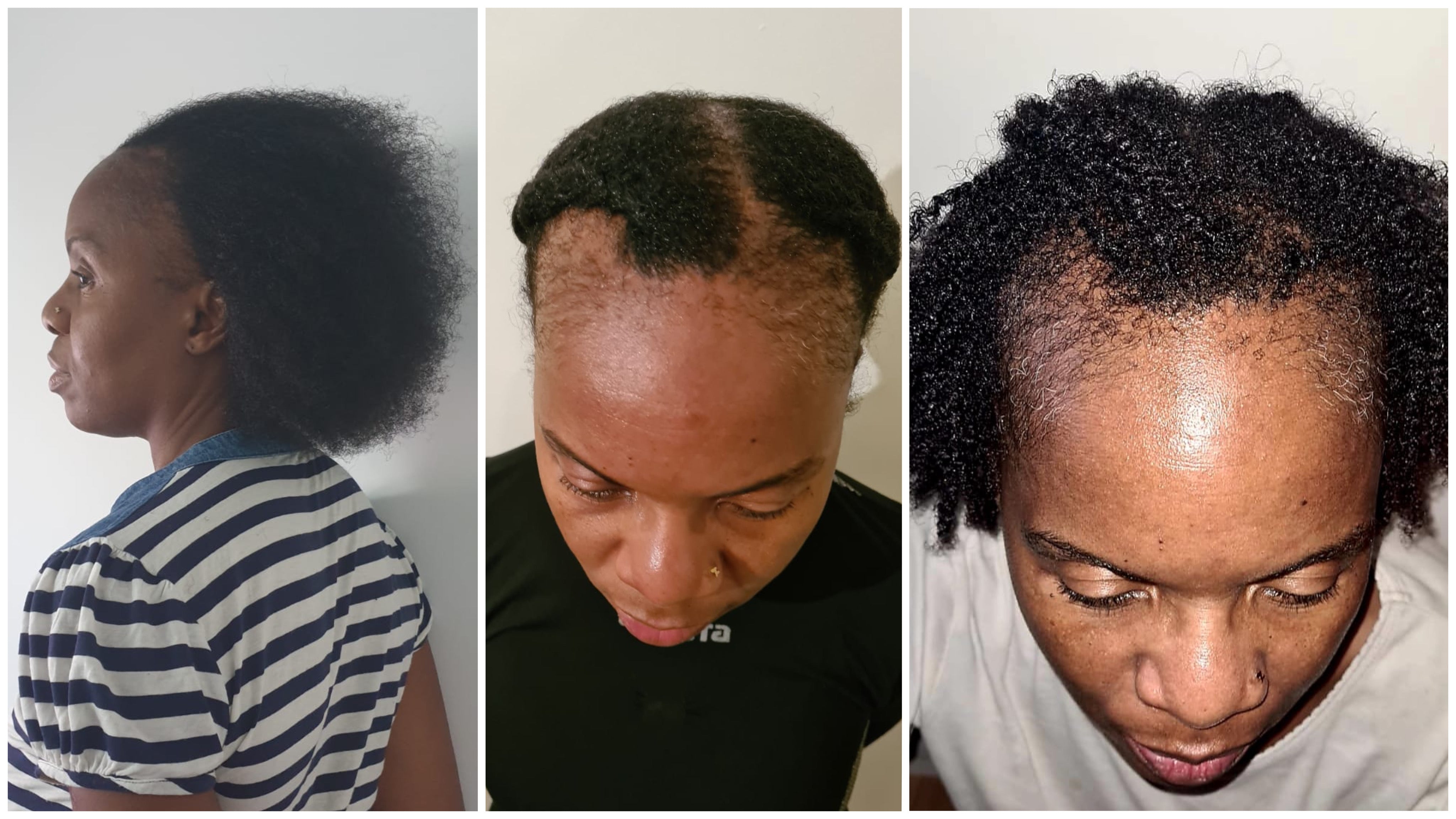 MYSCA Natural Cosmetics article huit incroyables transformations nella mysca beauté soins cheveux chevelure capillaire