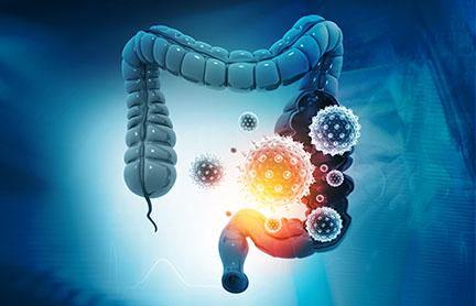 Graphic of the large intestine with germs and microbes closing in