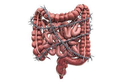 image of intestines caught in barbed wire