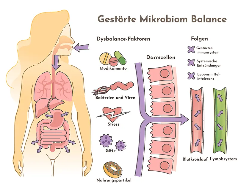 Gestörte Mikrobiom Balance