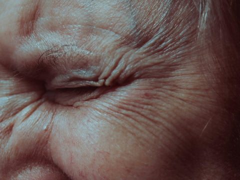 A close-up of a person's face with wrinkles,