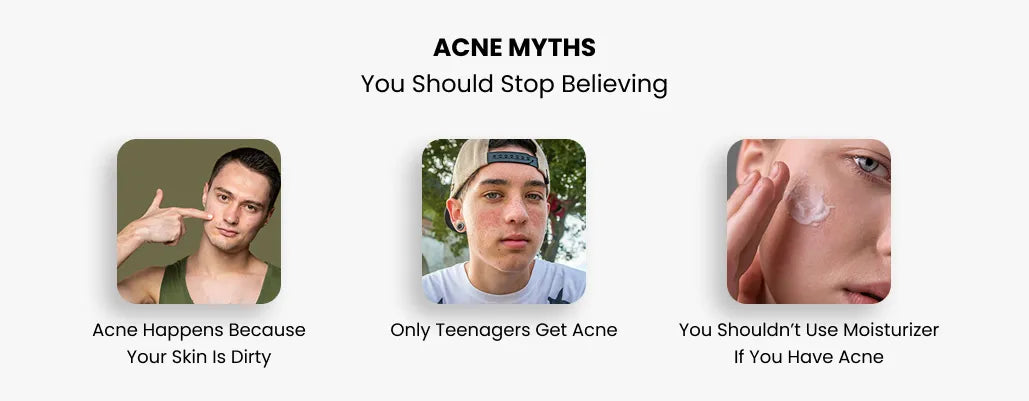 Acne Myths You Should Stop Believing