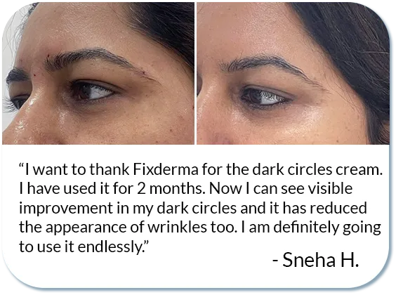 under eye cream