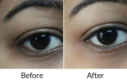 Eyegile-AM & PM cream Before & After