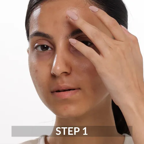 Apply the scar gel