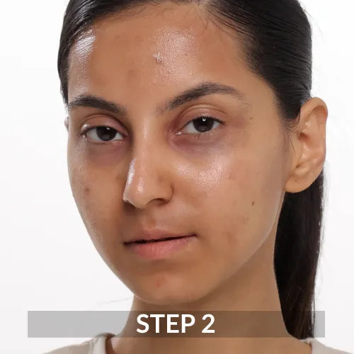 Scar gel Massage gently
