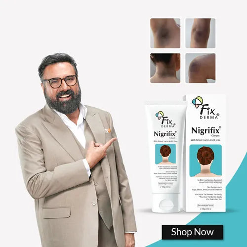 Nigrifix cream for body care