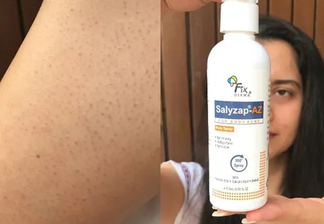 Salyzap Body Spray-Customer review