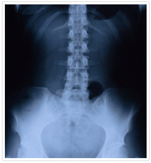 lower back x-ray