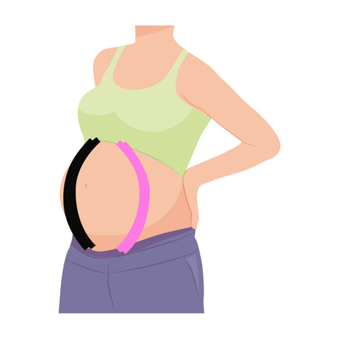 Les bénéfices du K-taping pendant la grossesse  l’écharpe ventrale