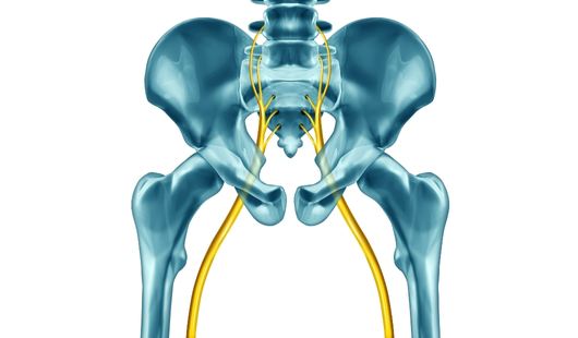 Le syndrome du piriforme causes, symptômes et traitements